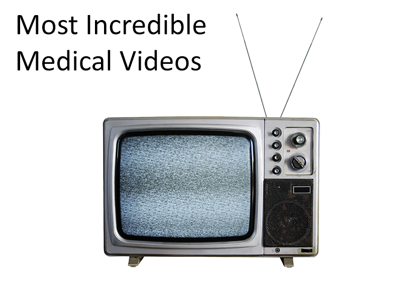 Most Incredible Medical Videos